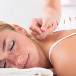 How To Prepare for Your First Acupuncture Visit