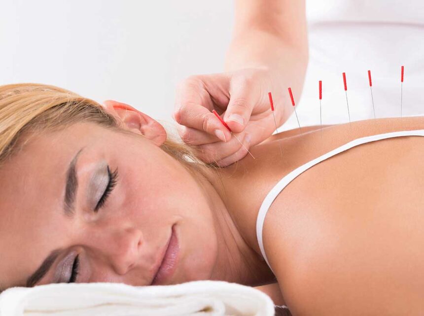 How To Prepare for Your First Acupuncture Visit